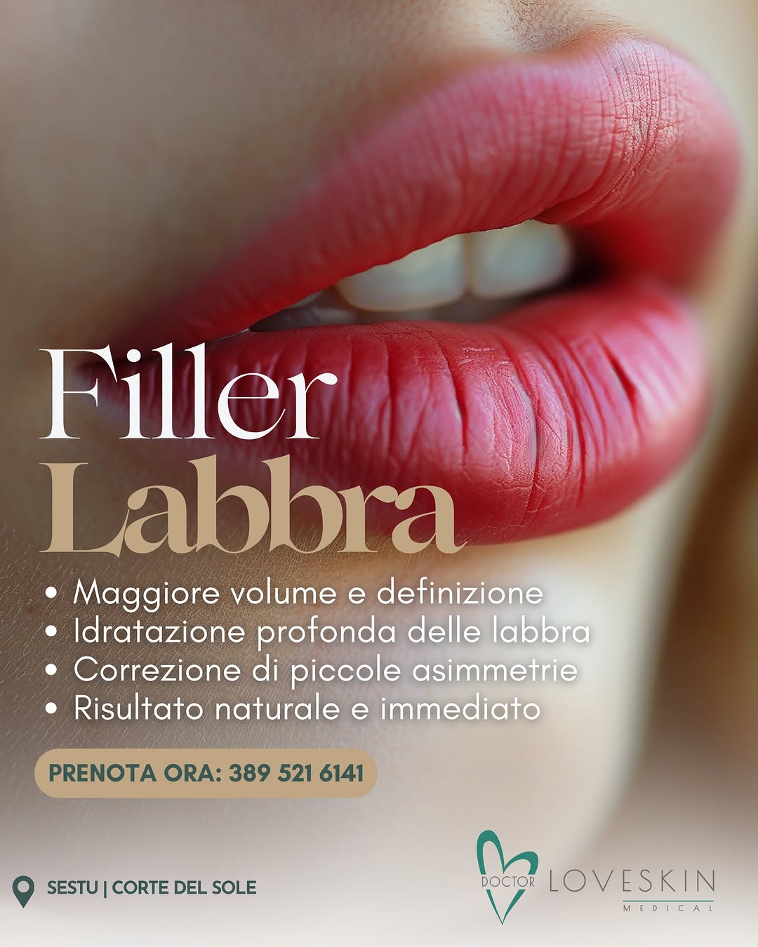 Filler labbra naturale